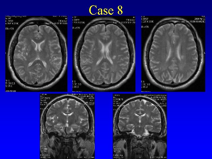Case 8 