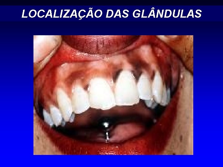 LOCALIZAÇÃO DAS GL NDULAS LOCALIZAÇÃO DAS GL NDULAS