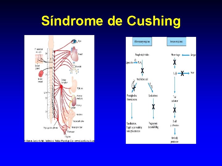 Síndrome de Cushing 