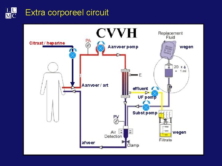 Extra corporeel circuit Citraat / heparine Aanvoer pomp wegen aanvoer Aanvoer / art effluent