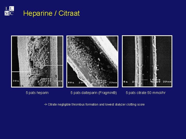 Heparine / Citraat 5 pats heparin 5 pats dalteparin (Fragmin®) 5 pats citrate 50