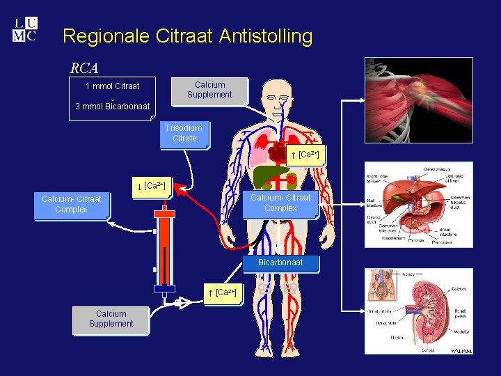 Regionale Citraat Antistolling RCA Calcium Supplement 1 mmol Citraat ↓ 3 mmol Bicarbonaat Trisodium
