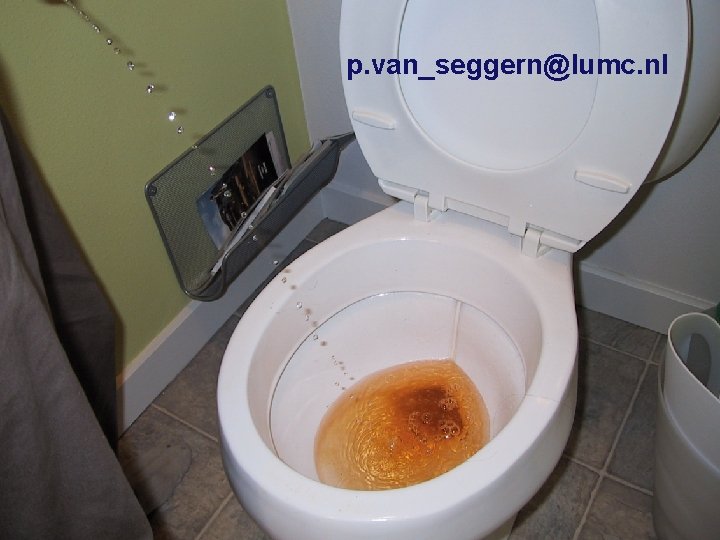 p. van_seggern@lumc. nl vragen? 