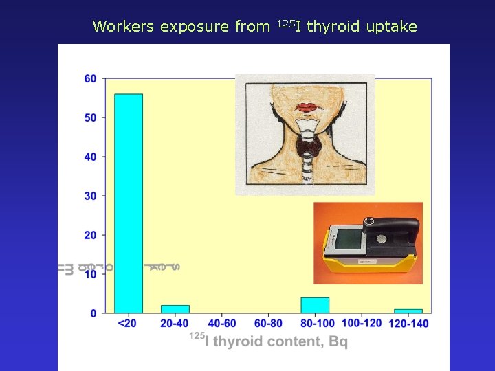 Workers exposure from 125 I thyroid uptake 