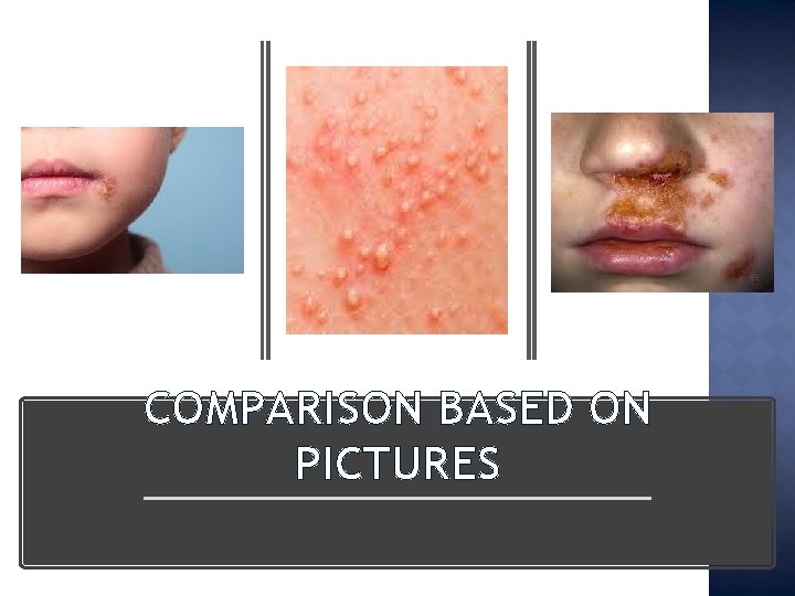 COMPARISON BASED ON PICTURES 