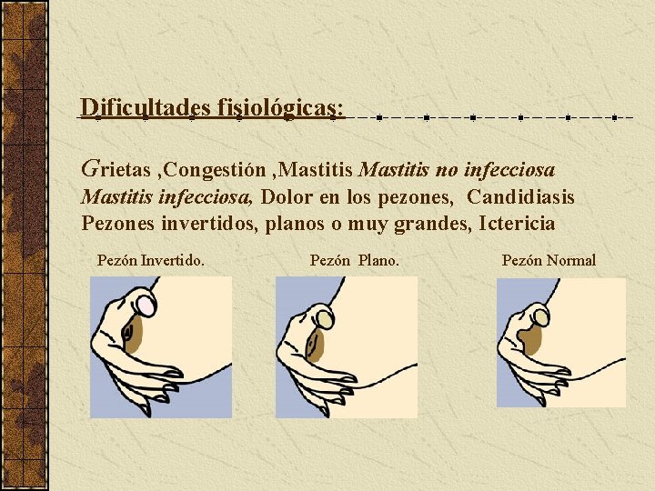 Dificultades fisiológicas: Grietas , Congestión , Mastitis no infecciosa Mastitis infecciosa, Dolor en los