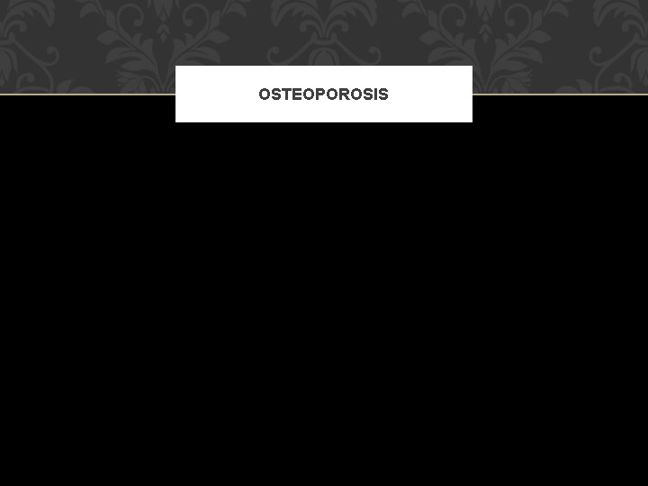 OSTEOPOROSIS 