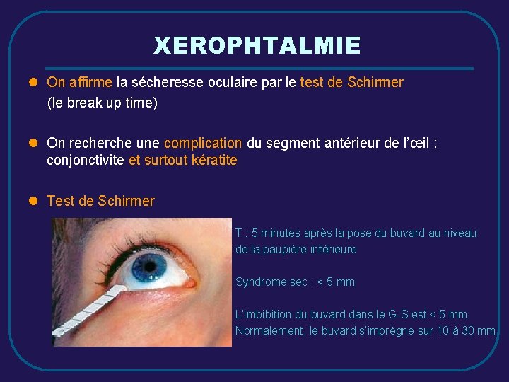 XEROPHTALMIE l On affirme la sécheresse oculaire par le test de Schirmer (le break