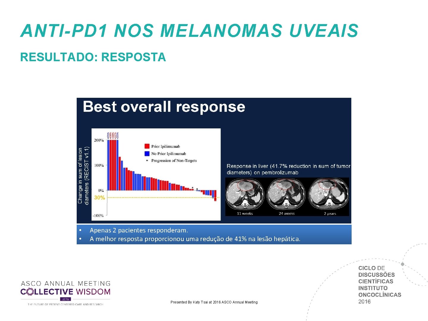 ANTI-PD 1 NOS MELANOMAS UVEAIS RESULTADO: RESPOSTA • • Apenas 2 pacientes responderam. A ANTI-PD 1 NOS MELANOMAS UVEAIS RESULTADO: RESPOSTA • • Apenas 2 pacientes responderam. A