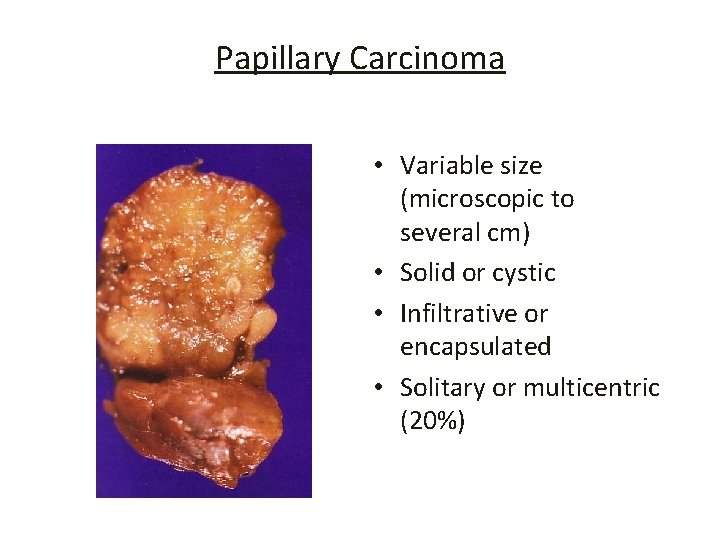 Papillary Carcinoma • Variable size (microscopic to several cm) • Solid or cystic •