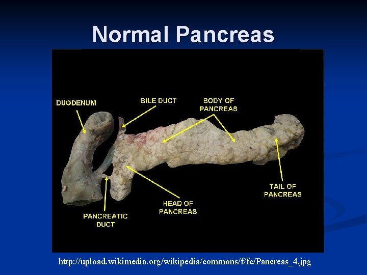 Normal Pancreas http: //upload. wikimedia. org/wikipedia/commons/f/fc/Pancreas_4. jpg 
