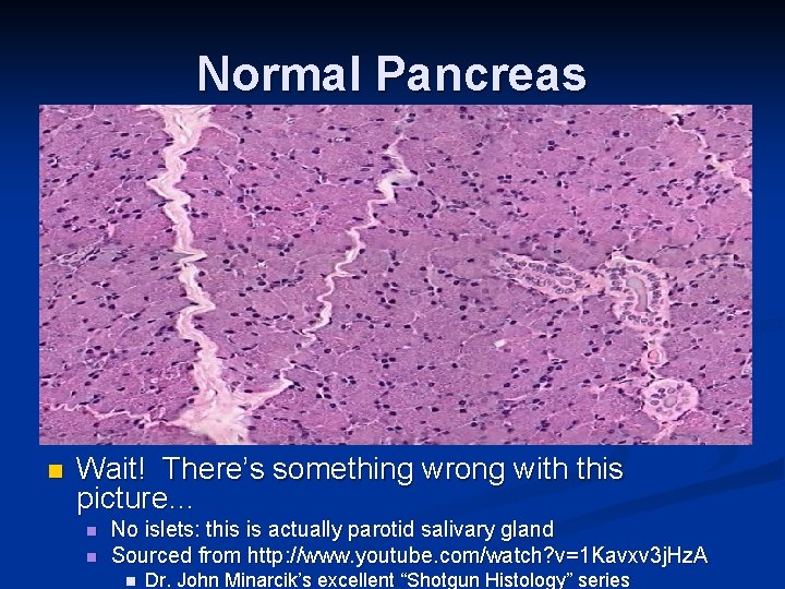 Normal Pancreas n Wait! There’s something wrong with this picture… n n No islets: