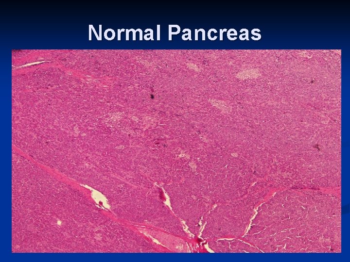 Normal Pancreas 