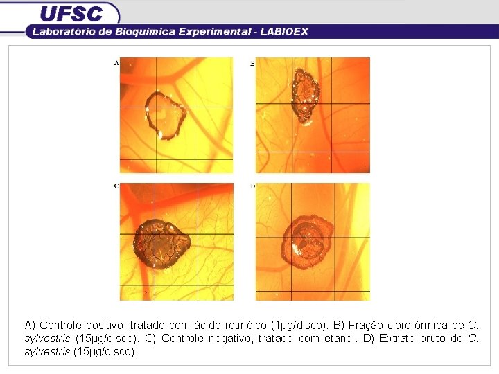 A) Controle positivo, tratado com ácido retinóico (1µg/disco). B) Fração clorofórmica de C. sylvestris