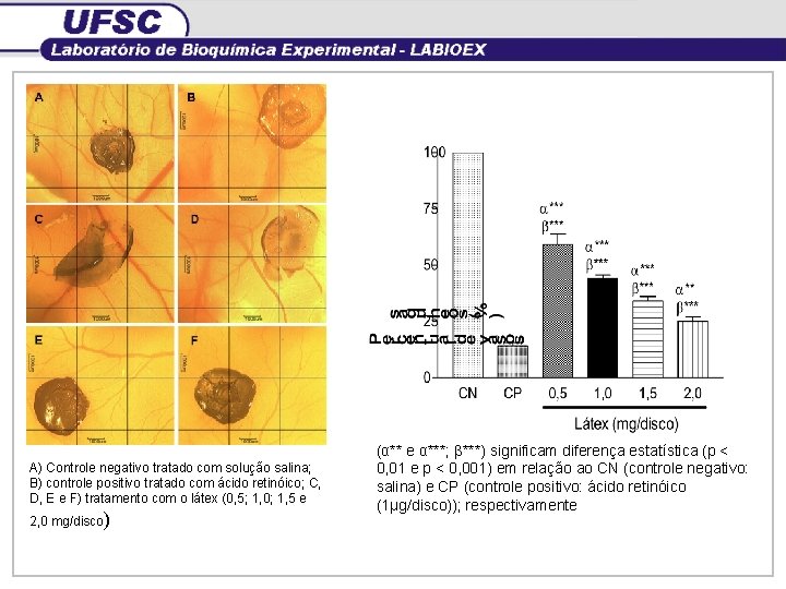 A) Controle negativo tratado com solução salina; B) controle positivo tratado com ácido retinóico;