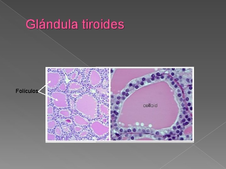 Glándula tiroides Folículos 
