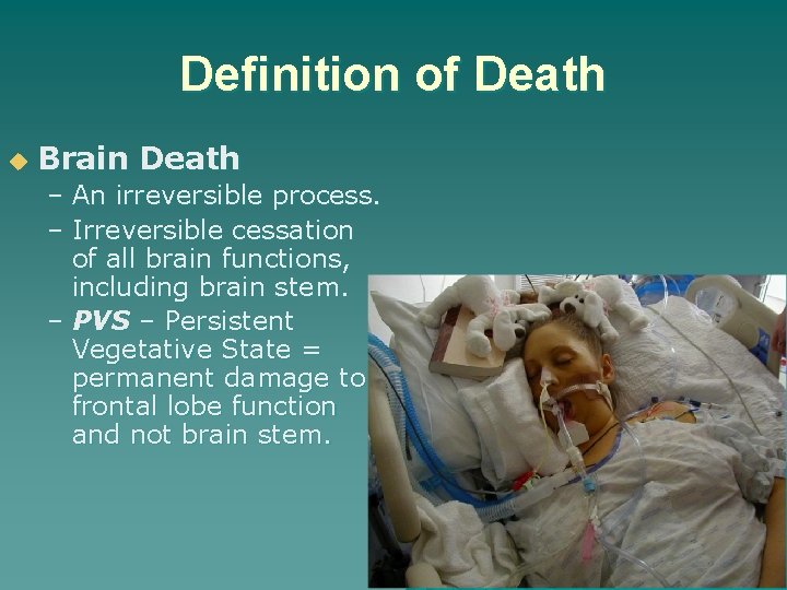 Definition of Death u Brain Death – An irreversible process. – Irreversible cessation of