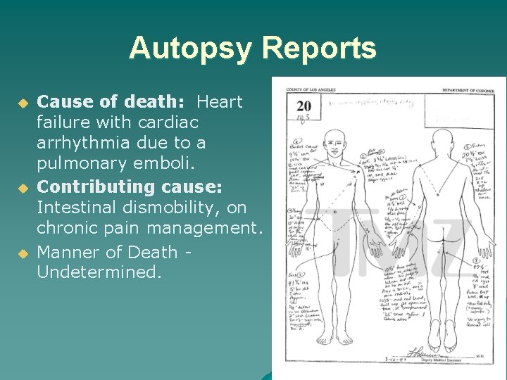 Autopsy Reports u u u Cause of death: Heart failure with cardiac arrhythmia due