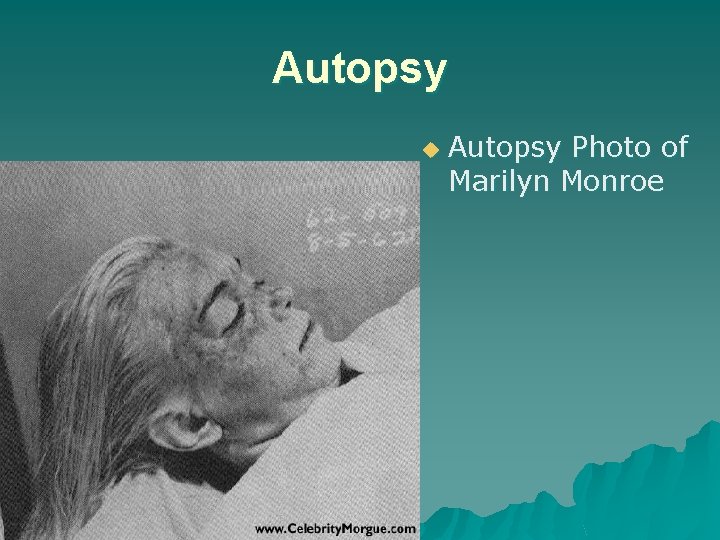Autopsy u Autopsy Photo of Marilyn Monroe 