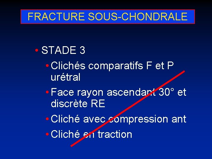 FRACTURE SOUS-CHONDRALE • STADE 3 • Clichés comparatifs F et P urétral • Face