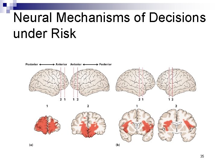 Neural Mechanisms of Decisions under Risk 35 