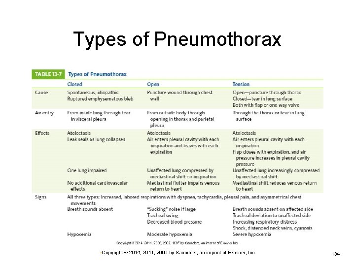 Types of Pneumothorax • Copyright © 2014, 2011, 2006 by Saunders, an imprint of