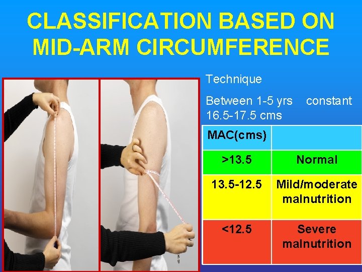 CLASSIFICATION BASED ON MID ARM CIRCUMFERENCE Technique Between 1 -5 yrs constant 16. 5