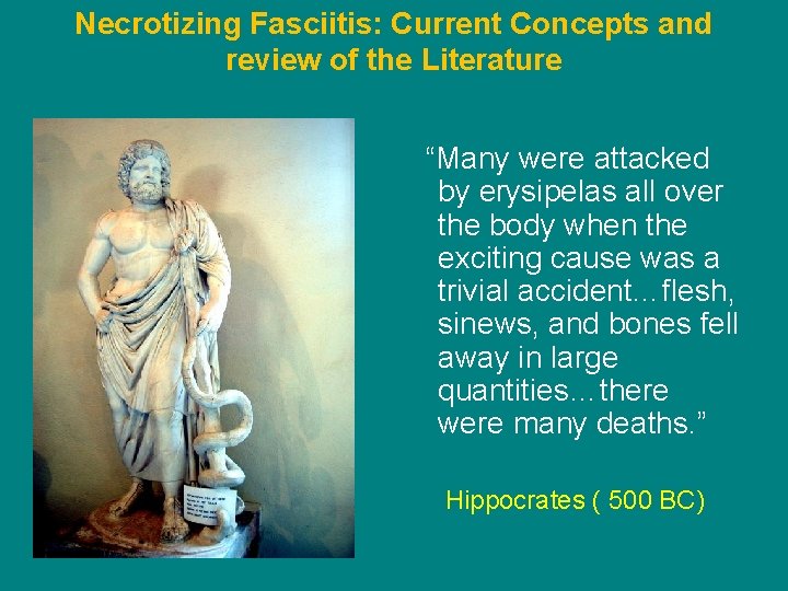 Necrotizing Fasciitis: Current Concepts and review of the Literature “Many were attacked by erysipelas