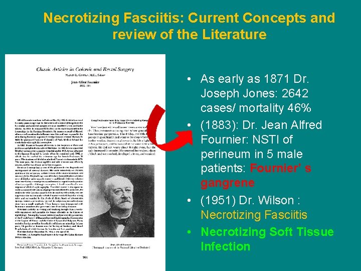 Necrotizing Fasciitis: Current Concepts and review of the Literature • As early as 1871