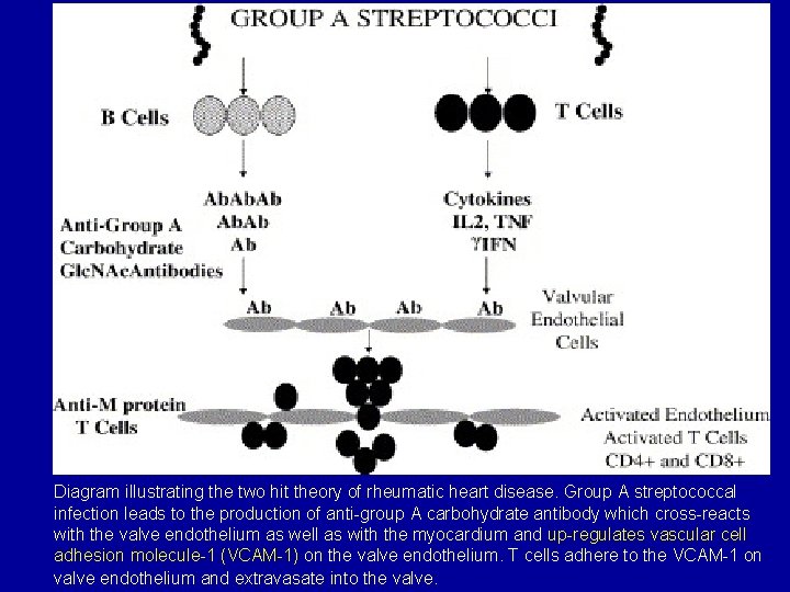 Diagram illustrating the two hit theory of rheumatic heart disease. Group A streptococcal infection