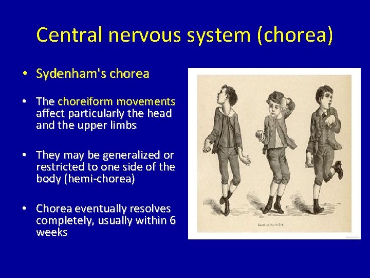 Central nervous system (chorea) • Sydenham's chorea • The choreiform movements affect particularly the