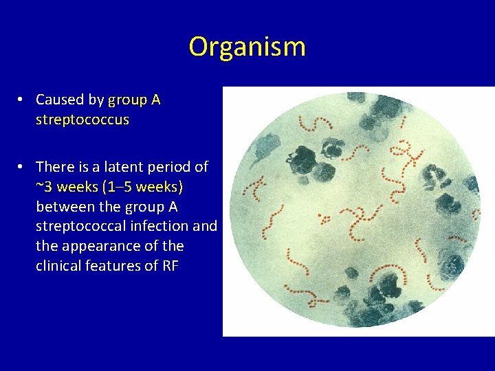 Organism • Caused by group A streptococcus • There is a latent period of