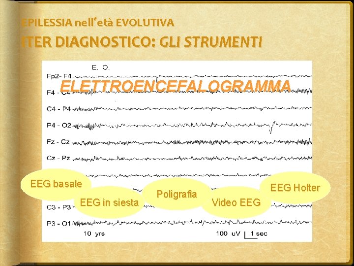 EPILESSIA nell’età EVOLUTIVA ITER DIAGNOSTICO: GLI STRUMENTI ELETTROENCEFALOGRAMMA EEG basale EEG in siesta Poligrafia