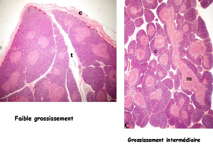 Faible grossissement Grossissement intermédiaire 