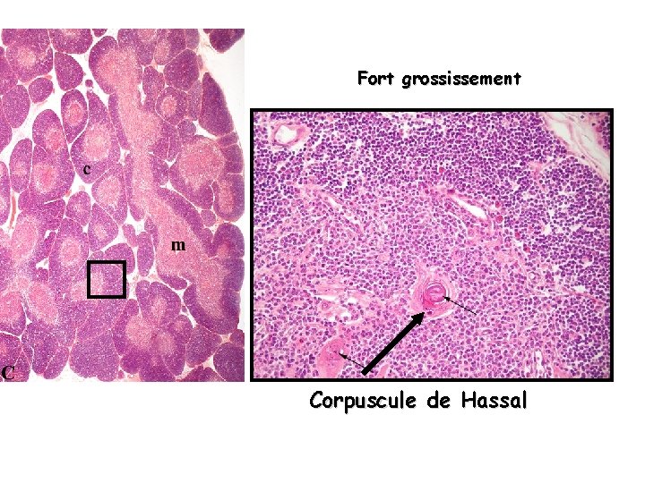 Fort grossissement Corpuscule de Hassal 