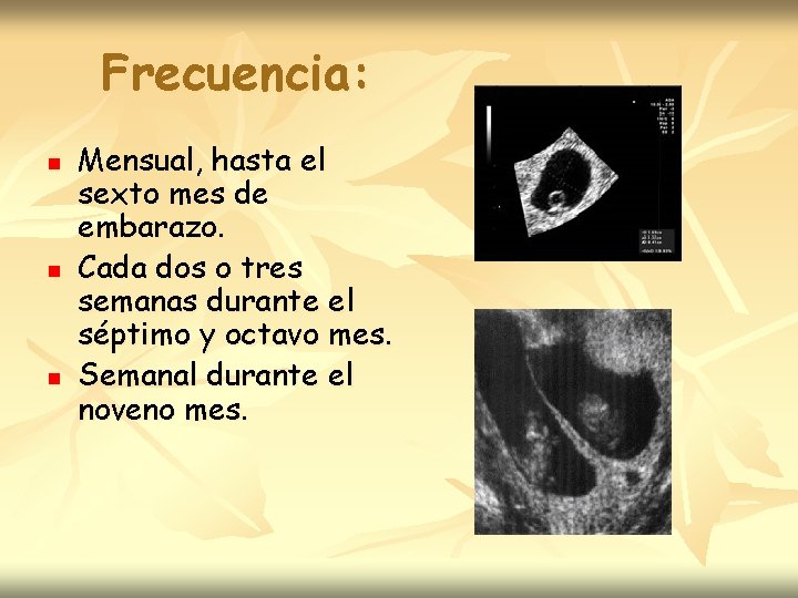 Frecuencia: n n n Mensual, hasta el sexto mes de embarazo. Cada dos o