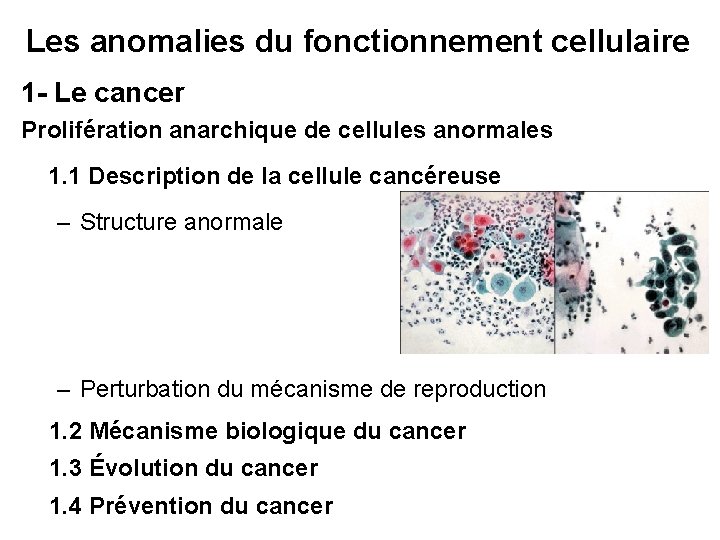 Les anomalies du fonctionnement cellulaire 1 - Le cancer Prolifération anarchique de cellules anormales