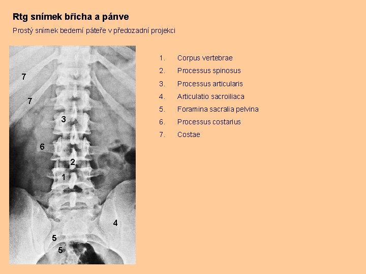 Rtg snímek břicha a pánve Prostý snímek bederní páteře v předozadní projekci 7 7