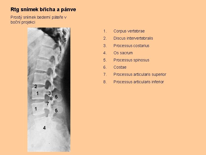 Rtg snímek břicha a pánve Prostý snímek bederní páteře v boční projekci 6 2