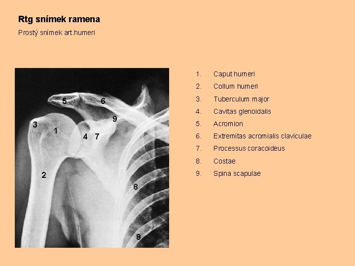 Rtg snímek ramena Prostý snímek art. humeri 5 6 9 3 1 4 7