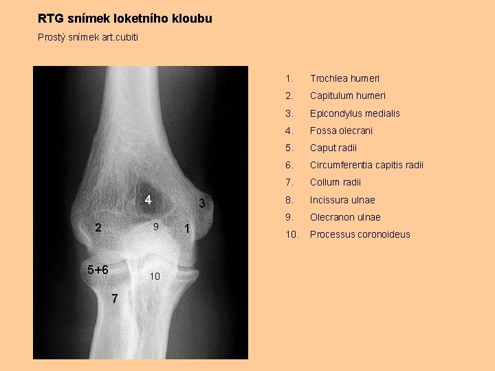RTG snímek loketního kloubu Prostý snímek art. cubiti 4 3 9 2 5+6 10