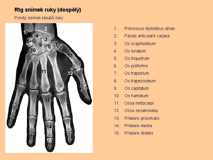 Rtg snímek ruky (dospělý) Prostý snímek kloubů ruky 2 1 4 5+6 3 9