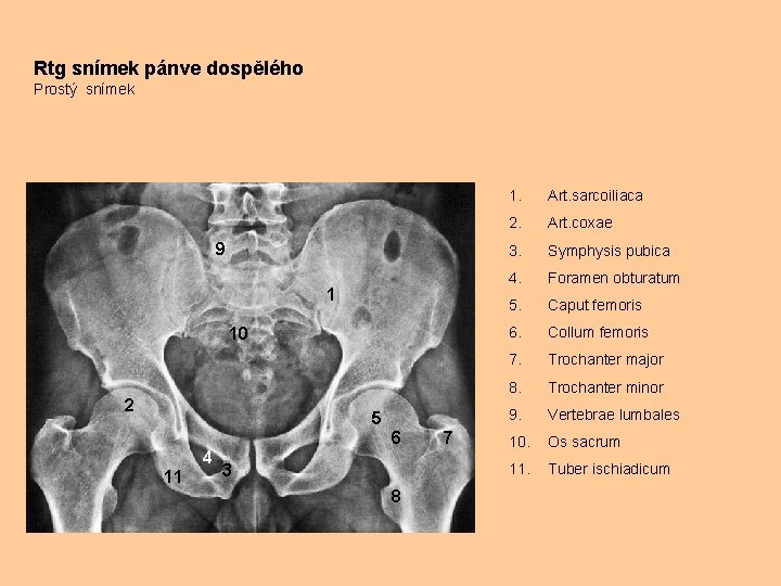 Rtg snímek pánve dospělého Prostý snímek 9 1 10 2 5 6 4 11