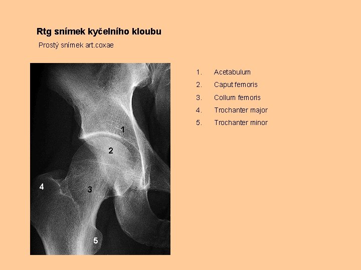 Rtg snímek kyčelního kloubu Prostý snímek art. coxae 1 2 4 3 5 1.