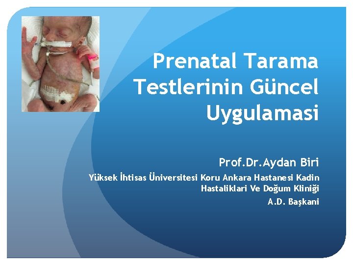 Prenatal Tarama Testlerinin Güncel Uygulamasi Prof. Dr. Aydan Biri Yüksek İhtisas Üniversitesi Koru Ankara