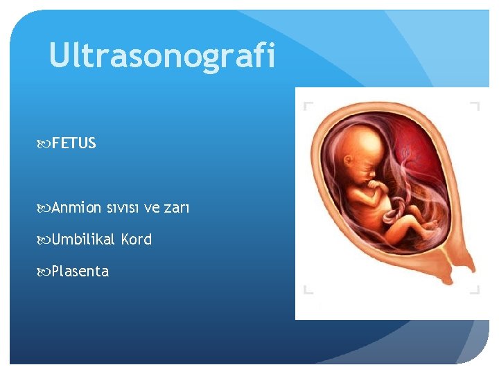 Ultrasonografi FETUS Anmion sıvısı ve zarı Umbilikal Kord Plasenta 