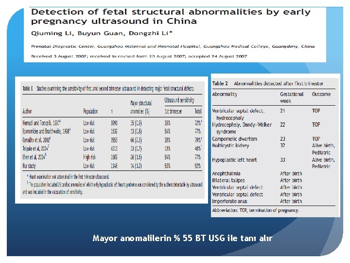 Mayor anomalilerin % 55 BT USG ile tanı alır 