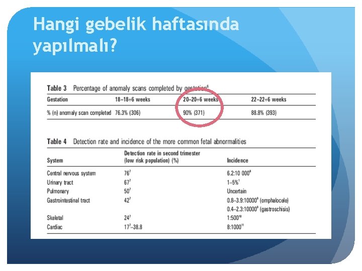 Hangi gebelik haftasında yapılmalı? 