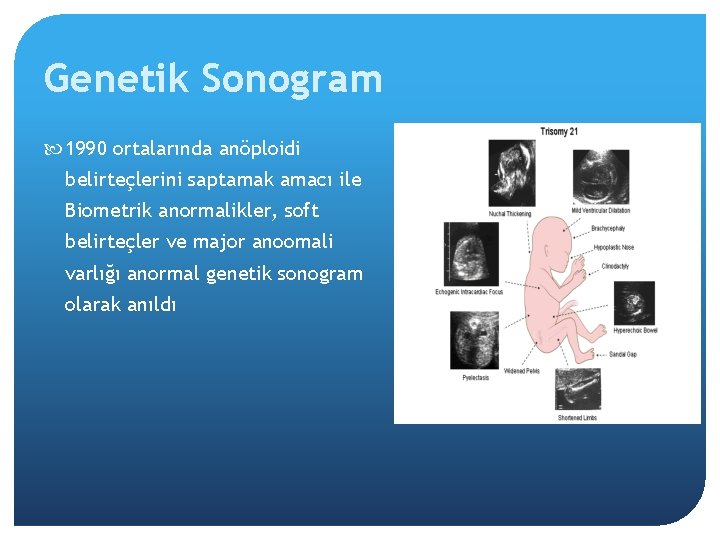 Genetik Sonogram 1990 ortalarında anöploidi belirteçlerini saptamak amacı ile Biometrik anormalikler, soft belirteçler ve