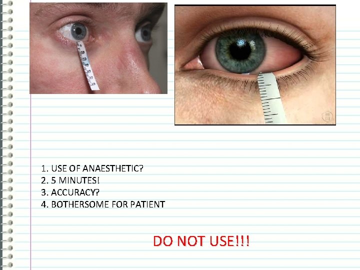 1. USE OF ANAESTHETIC? 2. 5 MINUTES! 3. ACCURACY? 4. BOTHERSOME FOR PATIENT DO